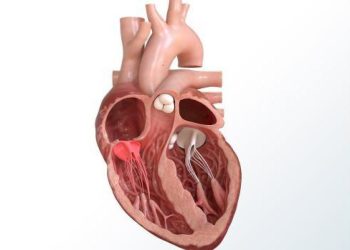 Kalp kapak tedavisinde ameliyatsız yöntemler! Kalp kapak hastalığının tedavisi…